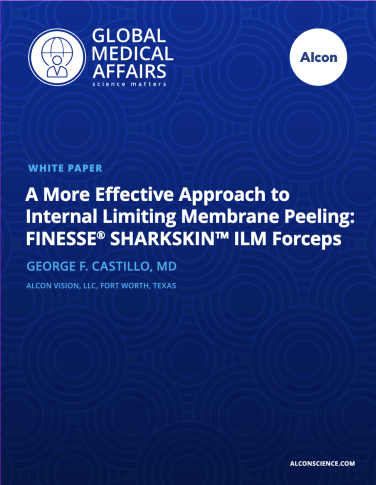 A More Effective Approach to Internal Limiting Membrane Peeling A More Effective Approach to Internal Limiting Membrane Peeling