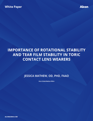 Importance Of Rotational Stability And Tear Film Stability In Toric Contact Lens Wearers Importance Of Rotational Stability And Tear Film Stability In Toric Contact Lens Wearers