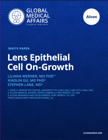 Lens Epithelial Cell On-Growth Lens Epithelial Cell On-Growth