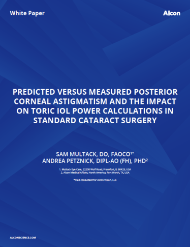 Predicted Versus Measured Posterior Corneal Astigmatism And The Impact On Toric IOL Power Calculations In Standard Cataract Surgery Predicted Versus Measured Posterior Corneal Astigmatism And The Impact On Toric IOL Power Calculations In Standard Cataract Surgery