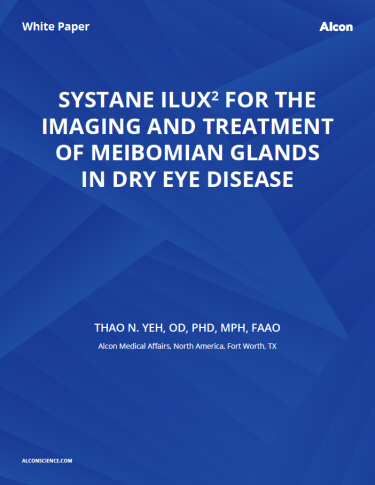 Systane iLux For the Imaging and Treatment of Meibomian Glands in Dry Eye Disease Systane iLux For the Imaging and Treatment of Meibomian Glands in Dry Eye Disease