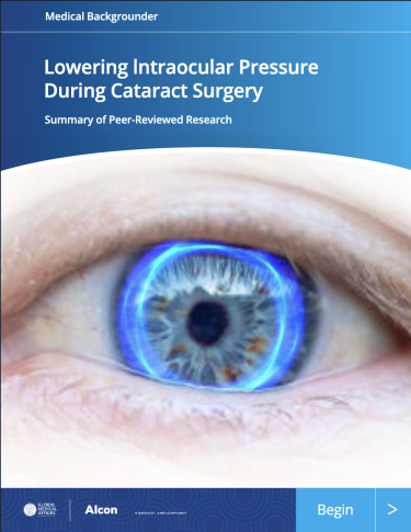 Lowering IOP Pressure During Cataract Surgery