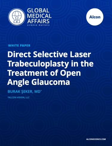 Direct Selective Laser Trabeculoplasty in the Treatment of Open Angle Glaucoma