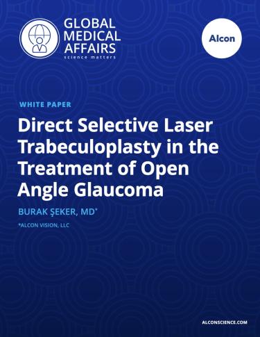 Direct Selective Laser Trabeculoplasty in the Treatment of Open Angle Glaucoma