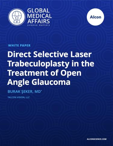 Direct Selective Laser Trabeculoplasty in the Treatment of Open Angle Glaucoma