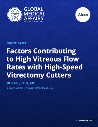 Factors Contributing to High Vitreous Flow Rates with High-Speed Vitrectomy Cutters