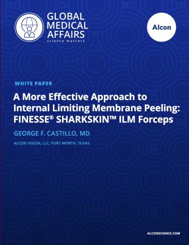 A More Effective Approach to Internal Limiting Membrane Peeling: FINESSE® SHARKSKIN™ ILM Forceps