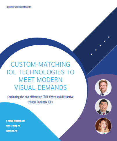 Custom-matching IOL technologies to meet modern visual demands. Combining the non-diffractive EDOF Vivity and diffractive trifocal PanOptix IOLs