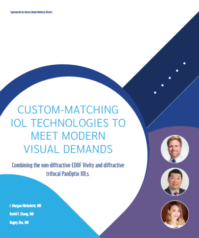 Custom-matching IOL technologies to meet modern visual demands. Combining the non-diffractive EDOF Vivity and diffractive trifocal PanOptix IOLs