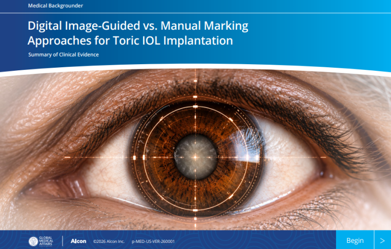 "Digital Image-Guided vs. Manual Marking Approaches for Toric IOL Implantation: Summary of Clinical Evidence"