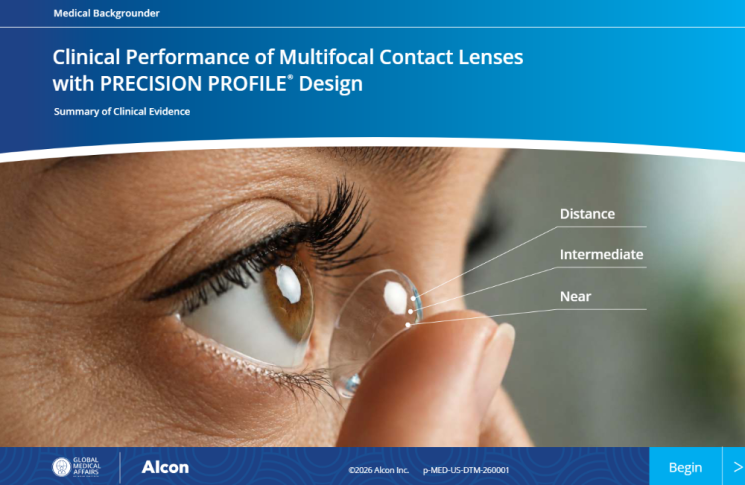 Clinical Performance of Multifocal Contact Lenses 